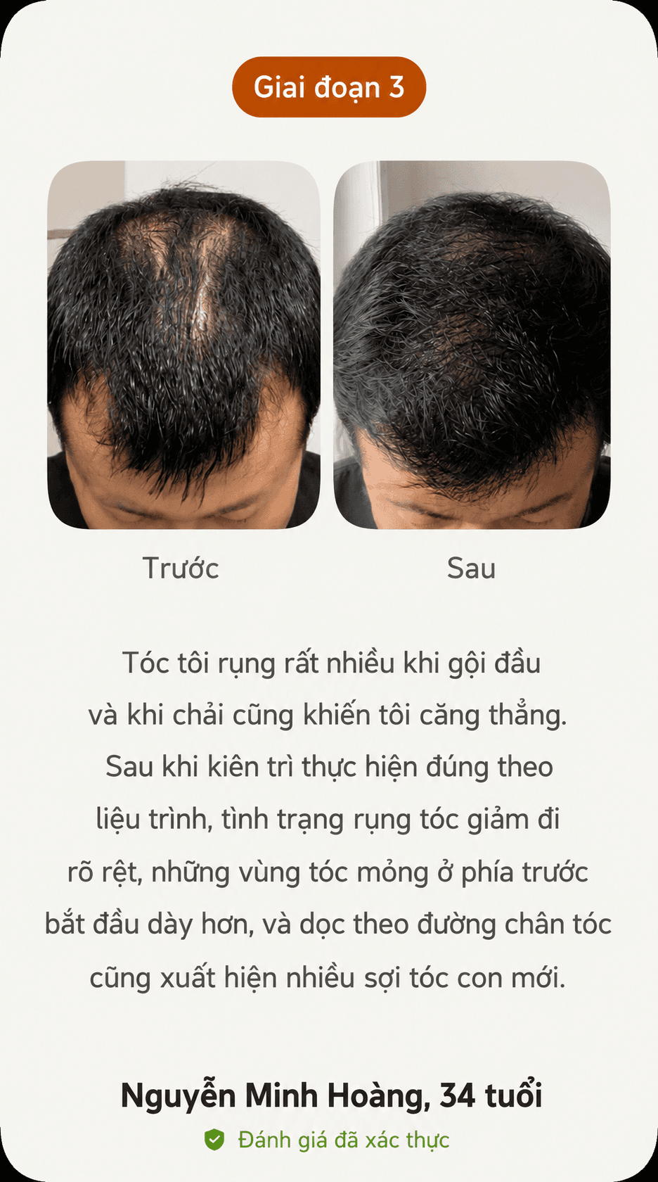 Kết quả thực tế trước và sau giai đoạn 2