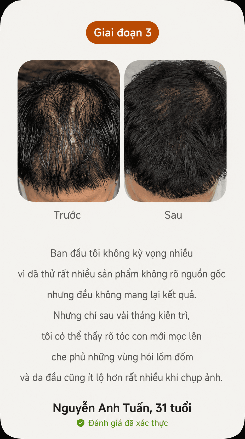 Kết quả thực tế trước và sau giai đoạn 4